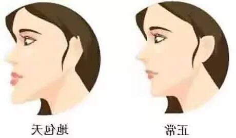 地包天 意思